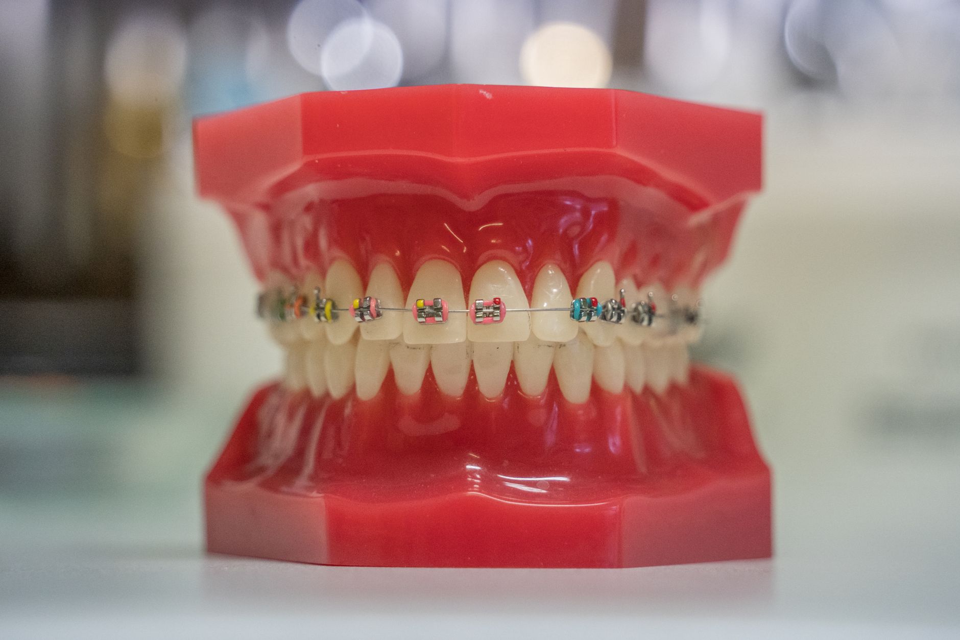 Modelo de arcada dentária com aparelho fixo e borrachinhas coloridas, sobre bancada clara.