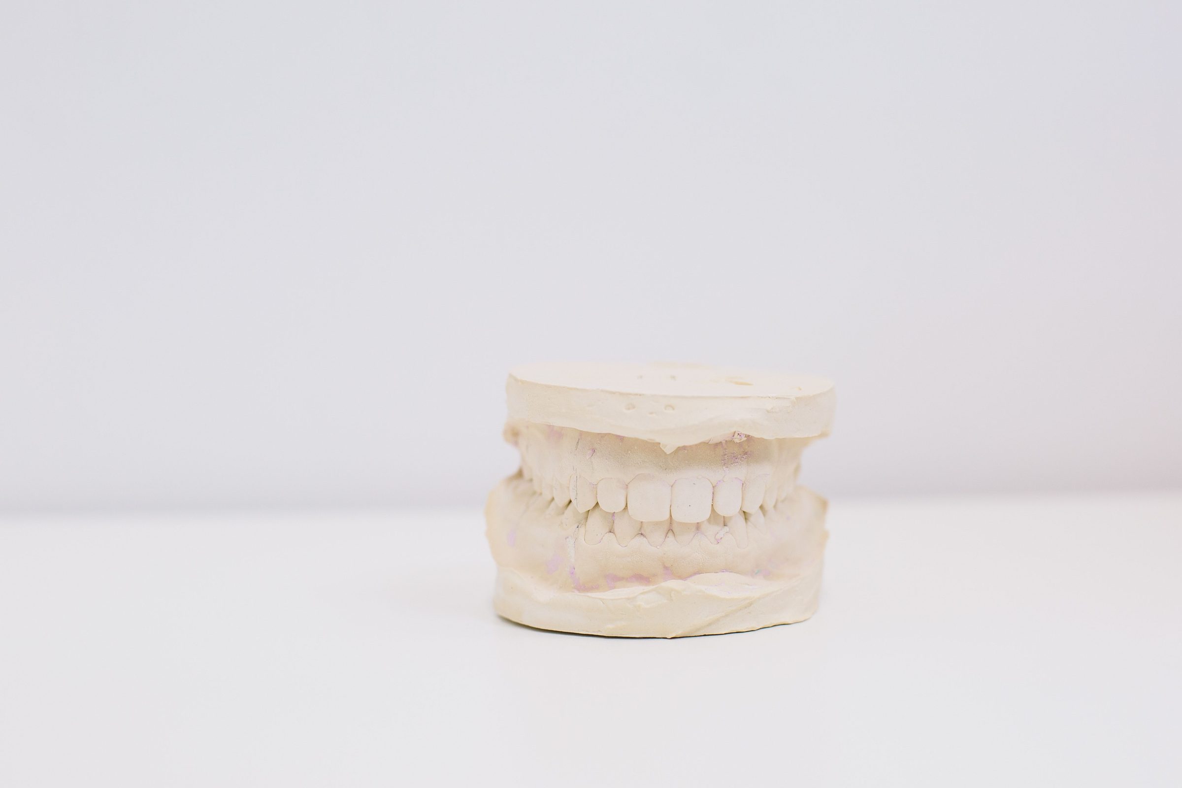 Modelo de gesso de uma arcada dentária sobre superfície clara.
